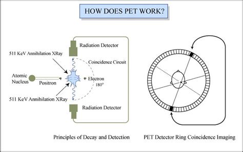 How Pet Works Diagram Of How Positron Emission Tomography Flickr