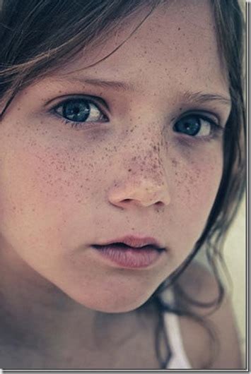 Bintik hitam disebut juga dengan istilah hiperpigmentasi. 10 Petua Cara Hilangkan Jeragat di Muka dan Badan | emajalah2u