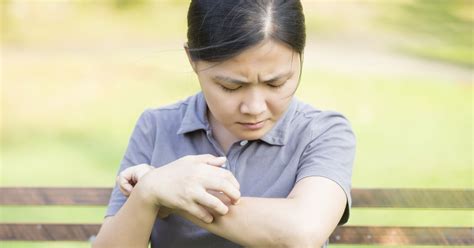 Causes Of Itching Without Rash Livestrongcom