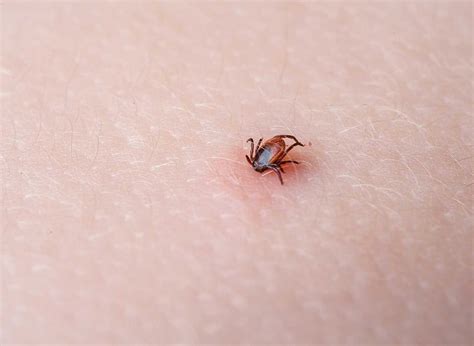 Oftast får man lindriga besvär så som feber, muskelvärk eller huvudvärk, men. Twinrix - Vaccin mot Hepatit A+B