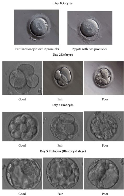 Morphology And Quality Of Embryos At Days 1 2 3 And 5 Download