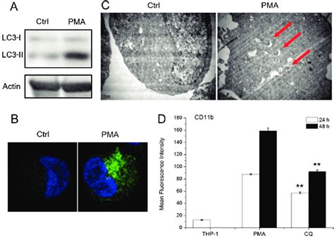 Autophagy Is Activated During Pma Induced Thp 1 Monocyte Download