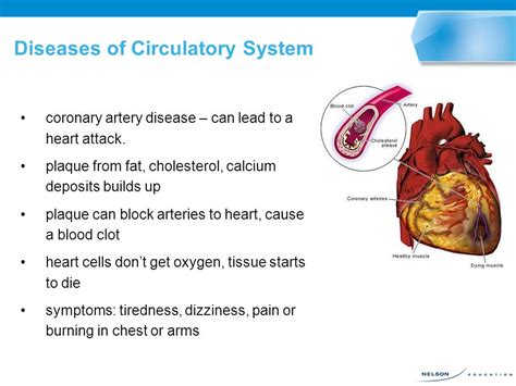 Different Circulatory Diseases