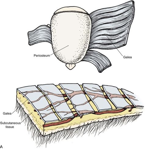 24 Reconstruction Of The Scalp Pocket Dentistry