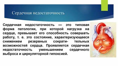 Сердечная недостаточность на диете Сердечная недостаточность на диете