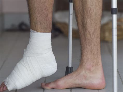 Ditch The Cast Some Broken Ankles May Heal In Half The Time
