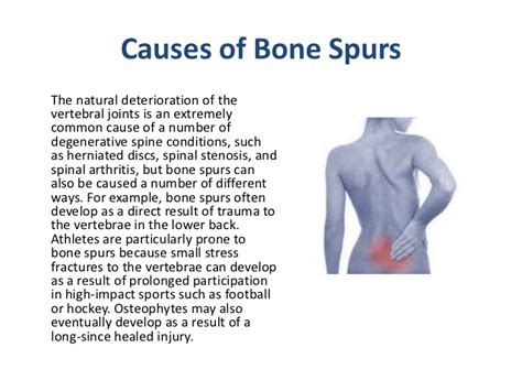 What to Expect from a Bone Spur in Your Back
