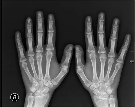 Ct (or cat) stands for computed (axial) tomography. How much does an X-ray cost near me? | From $40