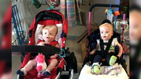 Conjoined Twins Thriving After Surgery To Separate Them Boston 25 News