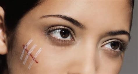 3 Tips Caseros Y Efectivos Para Borrar Cicatríces Mujer Ojo