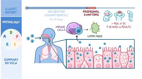 Chickenpox Varicella Nursing Process Adpie Osmosis Video Library