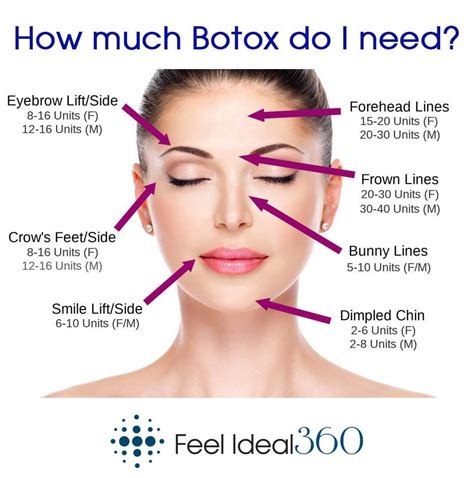 How Much Botox Do I Need Feel Ideal 360 Southlake