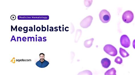 Megaloblastic Anemias Hematology Medicine Lectures Medical