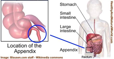 Is it appendicitis or something else? Appendix: Location, Function, Pain, and Symptoms of ...