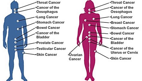 An Overview Of Types Of Cancer And Different Charities