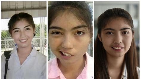 Thai Schoolgirl Learns To Smile Again After Teacher Assault Today