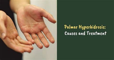 Palmar Hyperhidrosis Causes And Treatment