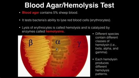 Microbiology Hemolysisblood Agar Youtube