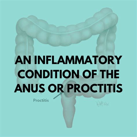 An Inflammatory Condition Of The Anus Or Proctitis Niruja Healthtech
