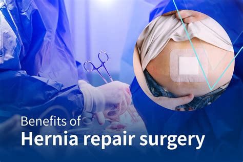 Hernia Surgery Benefits Risks Relief And Recovery