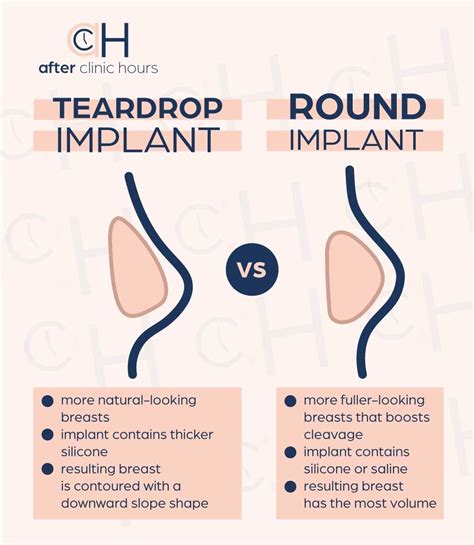 types of breast implants artofit