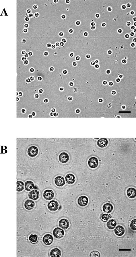 Hominis (formerly known as c. Light microscopic image of Cryptosporidium parvum oocysts ...
