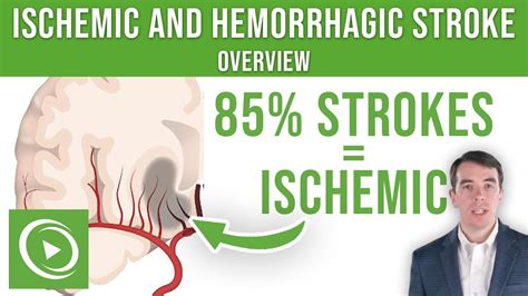 Overview Of Ischemic And Hemorrhagic Stroke Lecturio Youtube