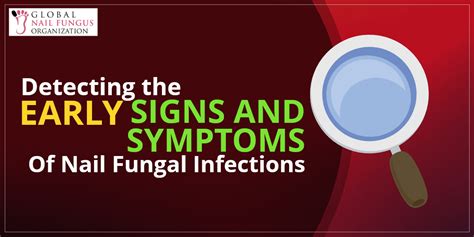 Detecting Early Signs And Symptoms Of Nail Fungal Infections Gnfo