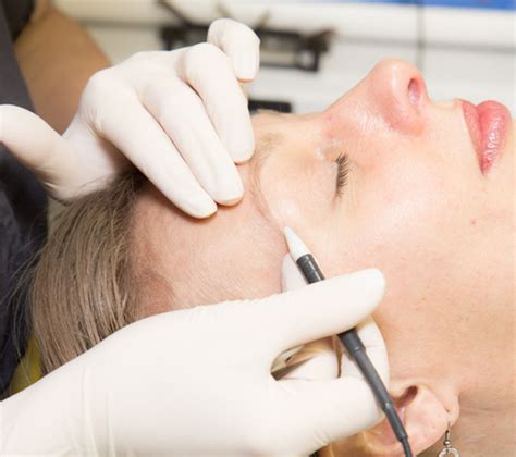 Learn About Electrolysis Superior Skin Care And Electrolysissuperior
