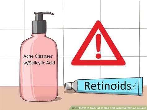 3 Ways To Get Rid Of Red And Irritated Skin On A Nose Wikihow