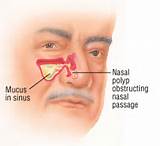 Nasal Doctor Pictures