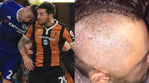 Both players were trying to get on the end of a cross when cahill. Ryan Mason retires due to skull fracture: Hull City ...