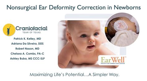 Ear Deformity Correction Infants Dell Childrens Craniofacial Team Of