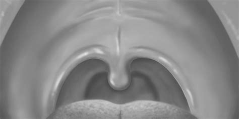 The Case Of The Surprising Uvula