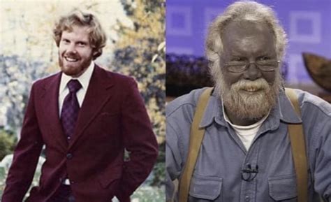 This Man Skin Turned Blue After Drinking Colloidal Silver For Over A
