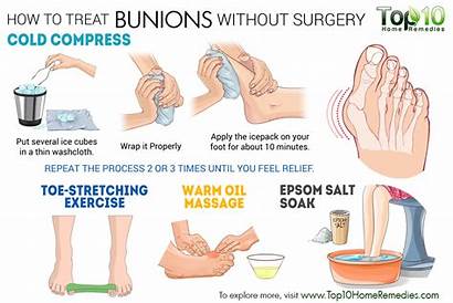 Bunions Without Surgery Treat Bunion Pain Remedies