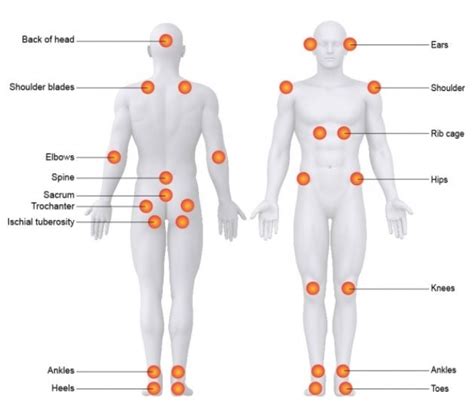 Anatomical terminology for hominids refers to the body in what is called standard anatomical position. common pressure sore locations的圖片搜尋結果 | Wound care, Wound ...
