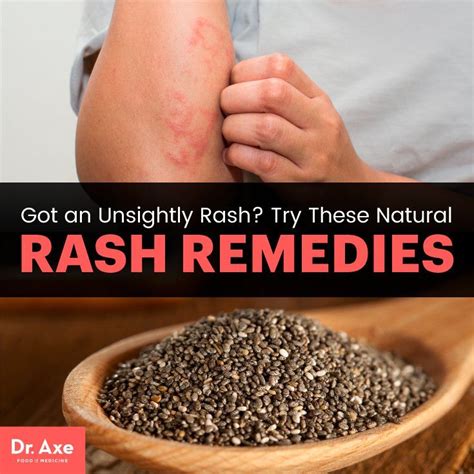 How To Get Rid Of A Rash 6 Natural Rash Remedies Dr Axe Rashes