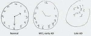 Put in all the numbers and set the time to 10 after 11. Montreal Cognitive Assessment - Wikipedia