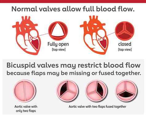 Funciones De Las Cuatro Válvulas Cardíacas American Heart Association