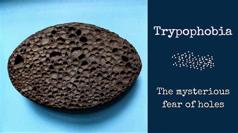 Trypophobia The Mysterious Holes In Hand Phobia