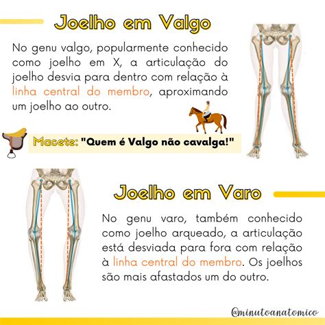 Alinhamento Valgo De Joelho