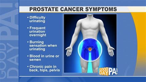 Prostate Cancer Symptoms Universal Health Products