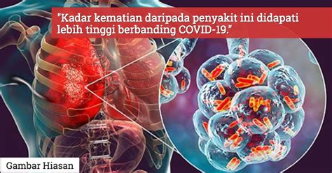 Nederlands english deutsch français italiano español svenska dansk suomi norwegian bokmål. Kedutaan China Beri Amaran Kewujudan Virus Pneumonia 'Tak ...