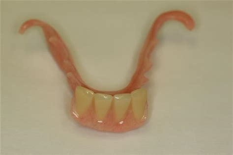 The Gallery For Partial Denture Front Teeth