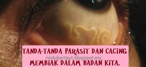 Mau tahu apa saja gejala kalau ada cacing pita dalam tubuh? Tanda-Tanda Parasit dan Cacing Membiak Di Dalam Badan Kita ...