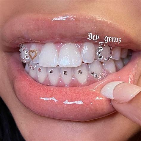 Whats My Favorite Worrrd Icy On Instagram Teeth On Shinyyy Explore