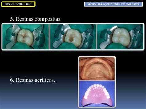 Clase 5 Biocompatibilidad De Los Materiales Dentales