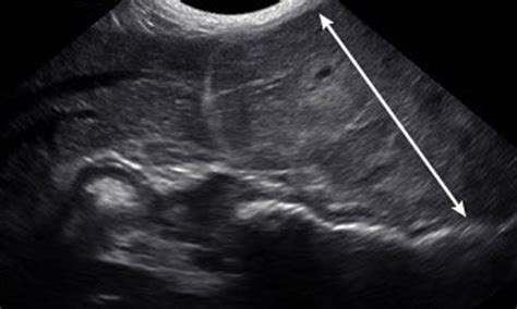 Hepatobiliary Imaging With Radiography And Ultrasonography Liver