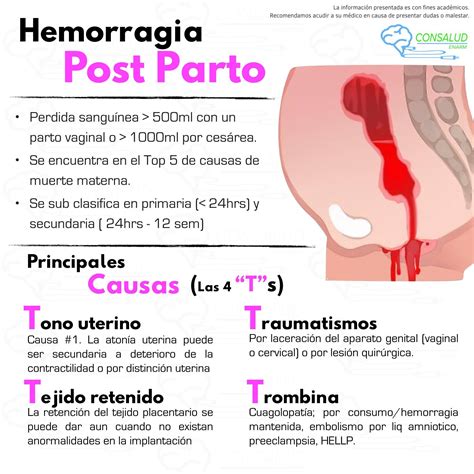 Hemorragia Post Parto Enfermer A Obstetricia Obstetricia Y